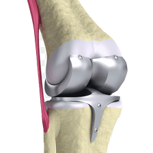 Knee