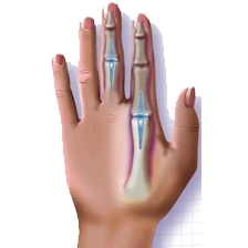 Hand