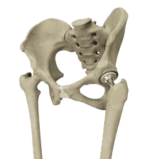 Hip