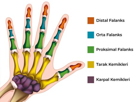 Fingertip Injury