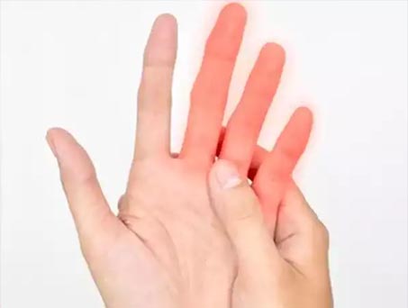Finger Amputation Injuries