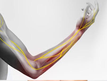 Vascular Injury